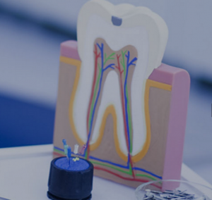 Root Canal Treatment South East London 