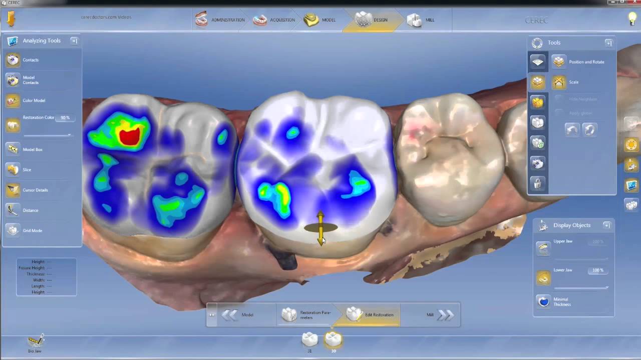 maxresdefault Green lane Dental Centre