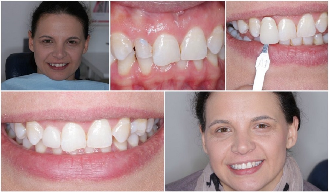 11111000x585 Green lane Dental Centre