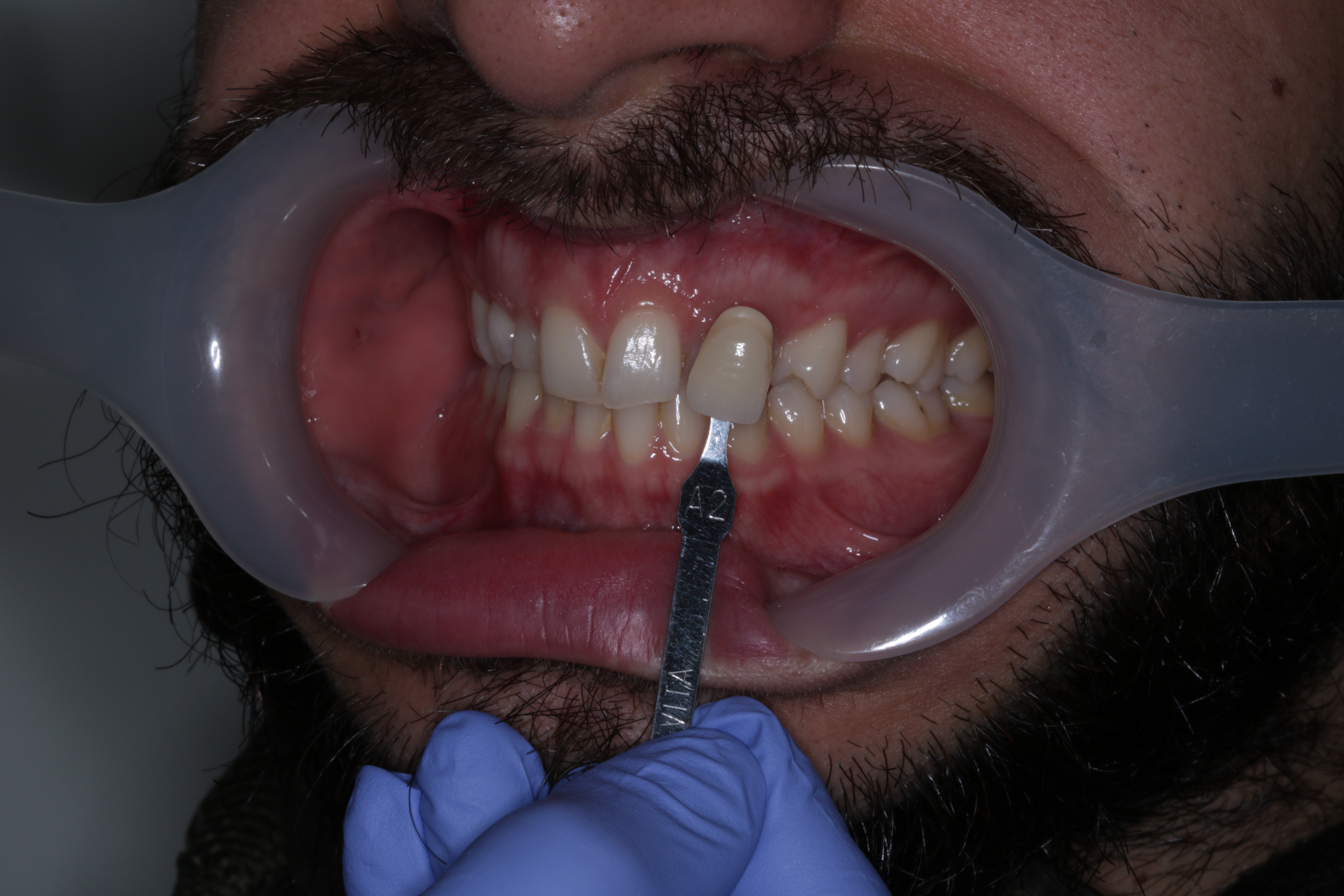 IMG_0359 Green lane Dental Centre