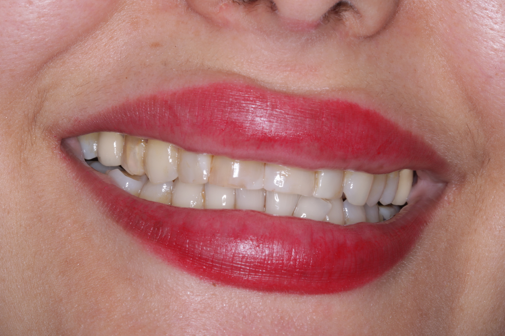 IMG_0859 Green lane Dental Centre