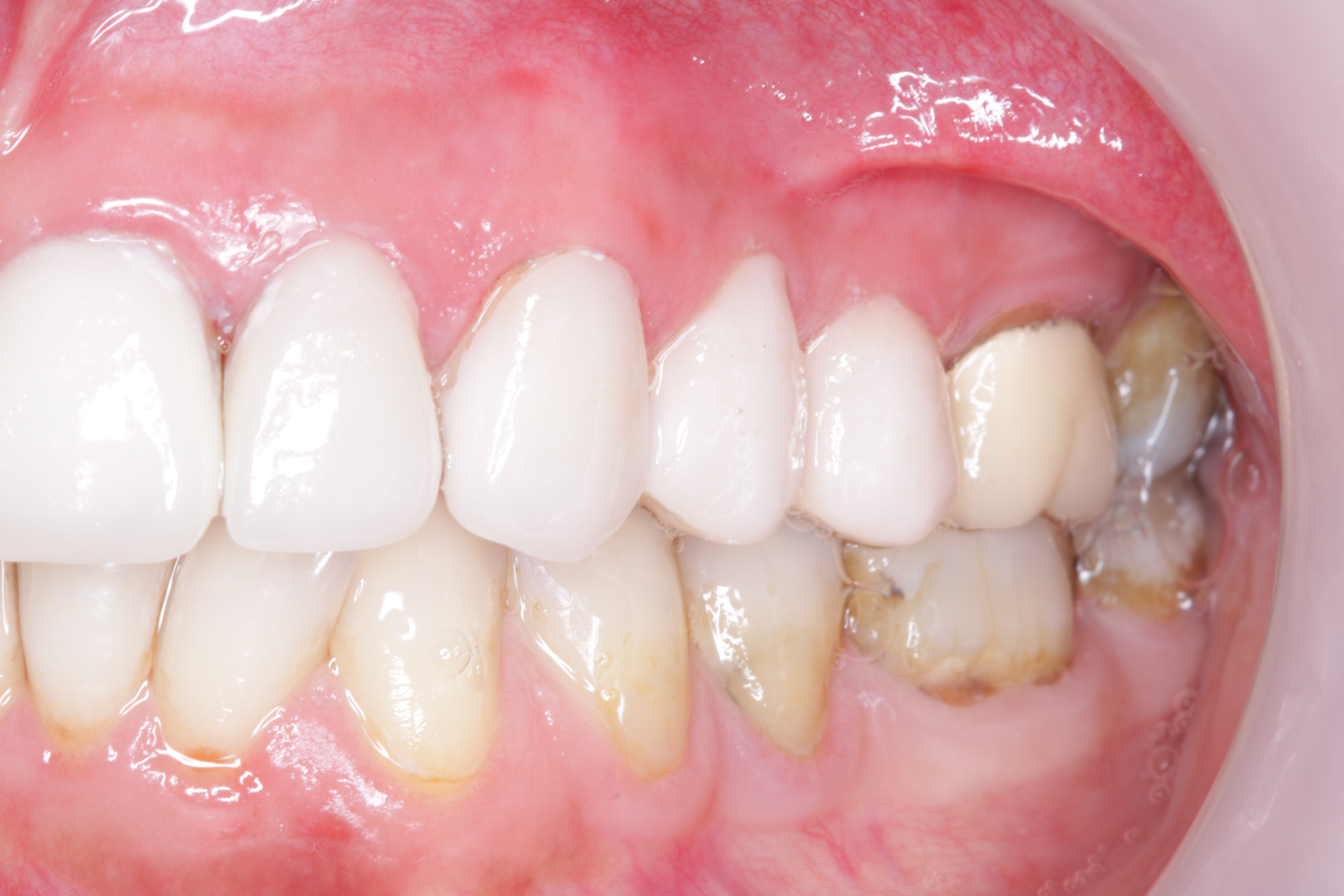 IMG_0864 Green lane Dental Centre