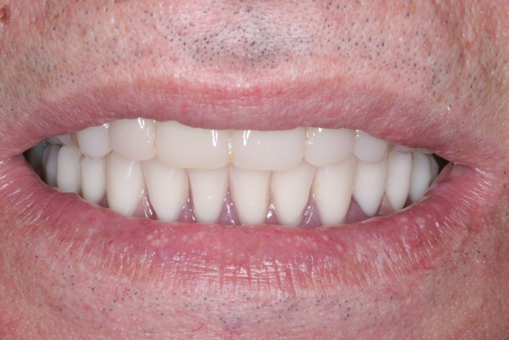 IMG_0880 Green lane Dental Centre