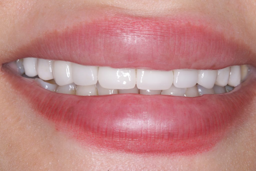 IMG_0895 Green Lane Dental Centre