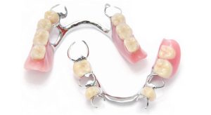 partial dentures nhs