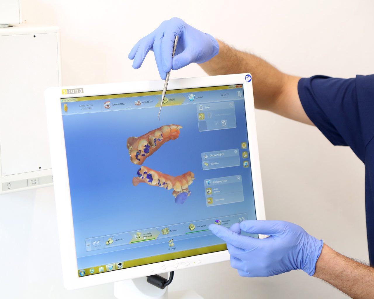 Green Lane Dental Centre Accepting New NHS Patients [SE20]