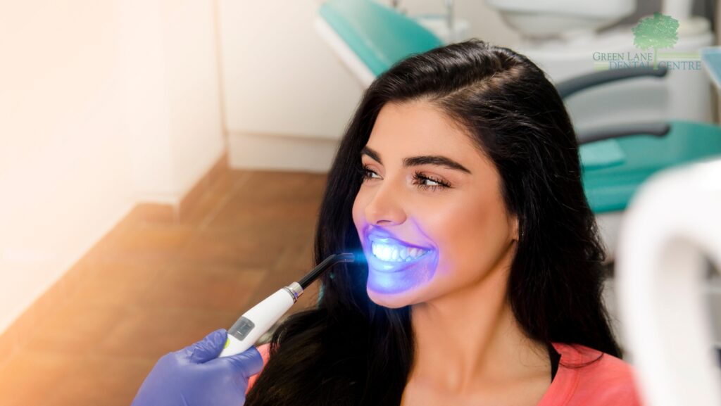 Professional Teeth Whitening in Penge for a bright and confident smile.
