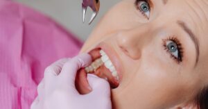 Tooth extraction in Penge with local anaesthesia for pain-free care 